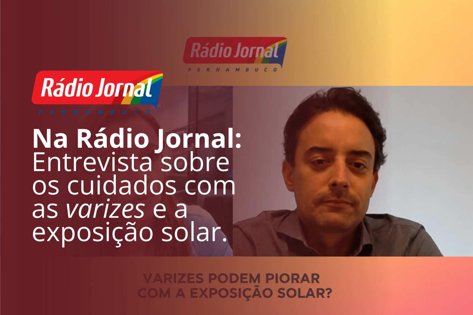 Entrevista do Dr. Bruno Canto sobre varizes